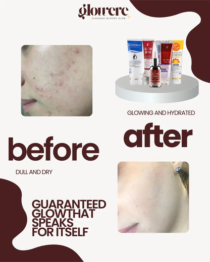 Buy 3 Get 2 Free - Skin Preserve & Rescue Bundle