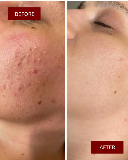 Perfect Glow Serum | Vit C + Arbutin