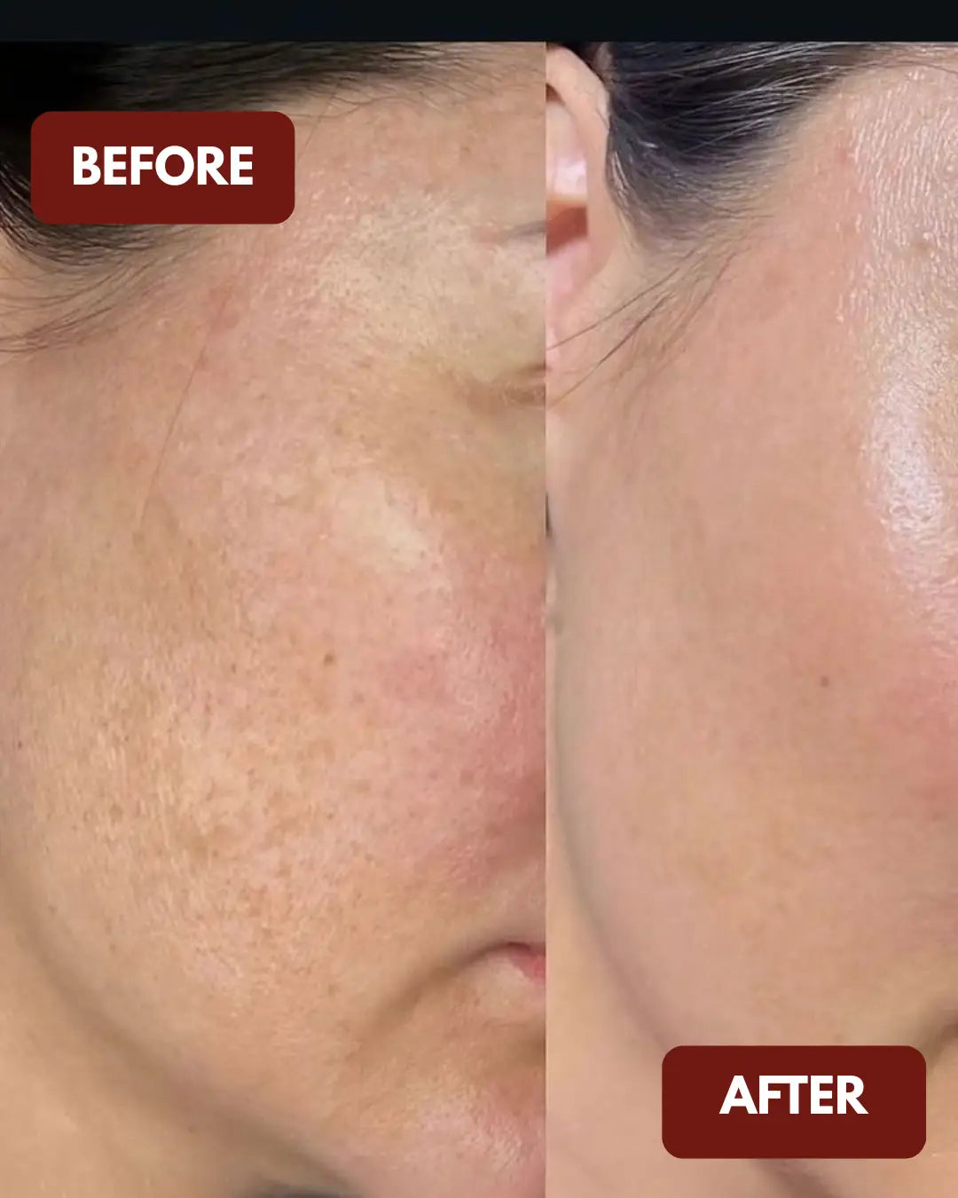 Perfect Glow Serum | Vit C + Arbutin