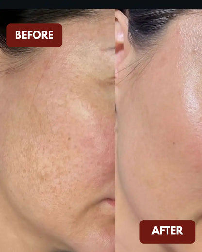 Perfect Glow Serum | Vit C + Arbutin