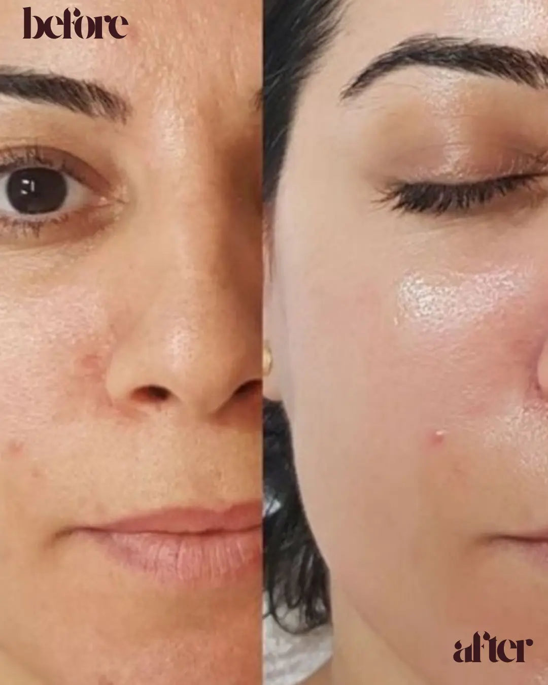 Perfect Glow Serum | Vit C + Arbutin