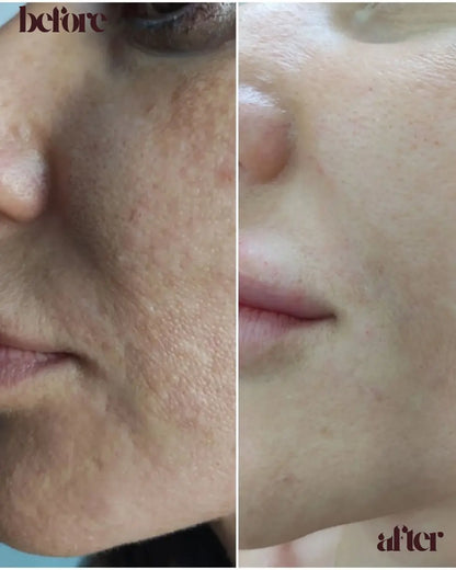 Perfect Glow Serum | Vit C + Arbutin