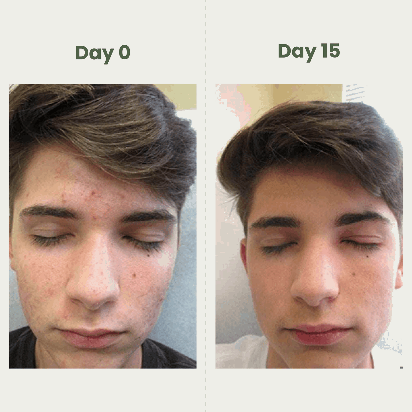 GlowCare Sunscreen SPF 60 | Zinc Oxide + Avobenzone