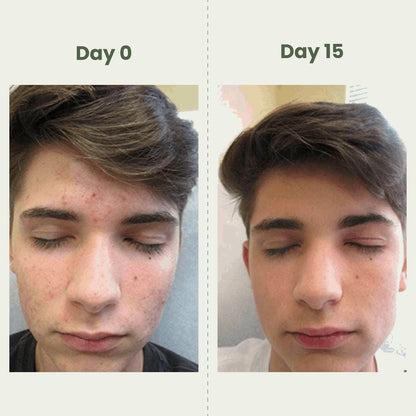 GlowCare Sunscreen SPF 60 | Zinc Oxide + Avobenzone